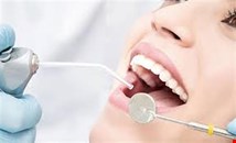 Tooth Filing
