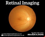 Get Advanced Retinal Imaging Service in London.