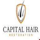 Capital Hair Restoration 