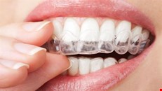 Cosmetic Dental Clinic in Trivandrum