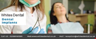 Dental implants london