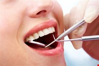 Dental Treatment Packages in India