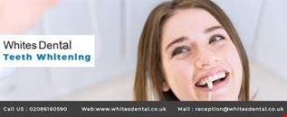  Instant teeth whitening 